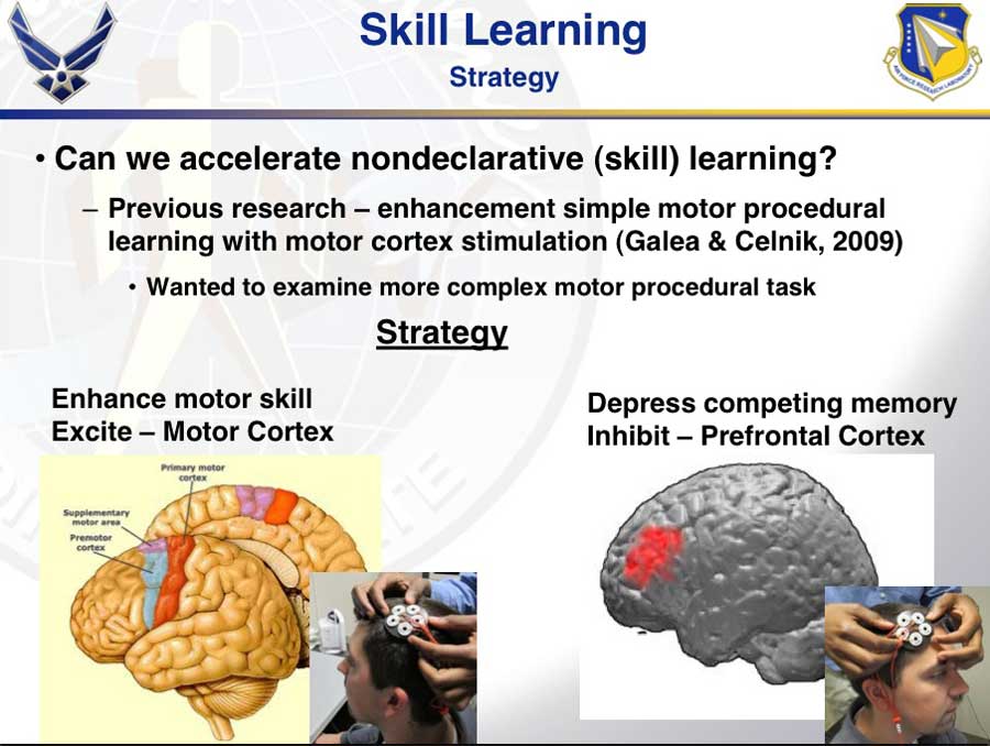 Tdcs Montage Chart